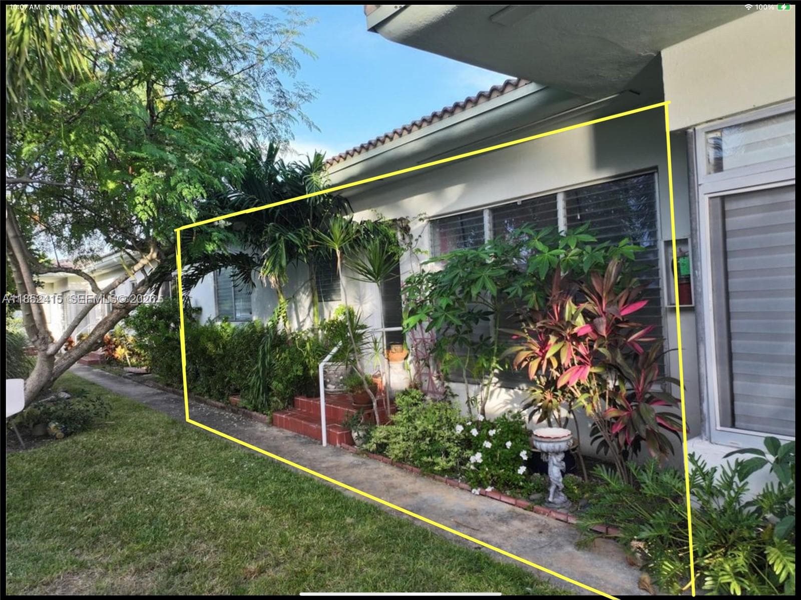 A11852415 — Miami Beach — 2