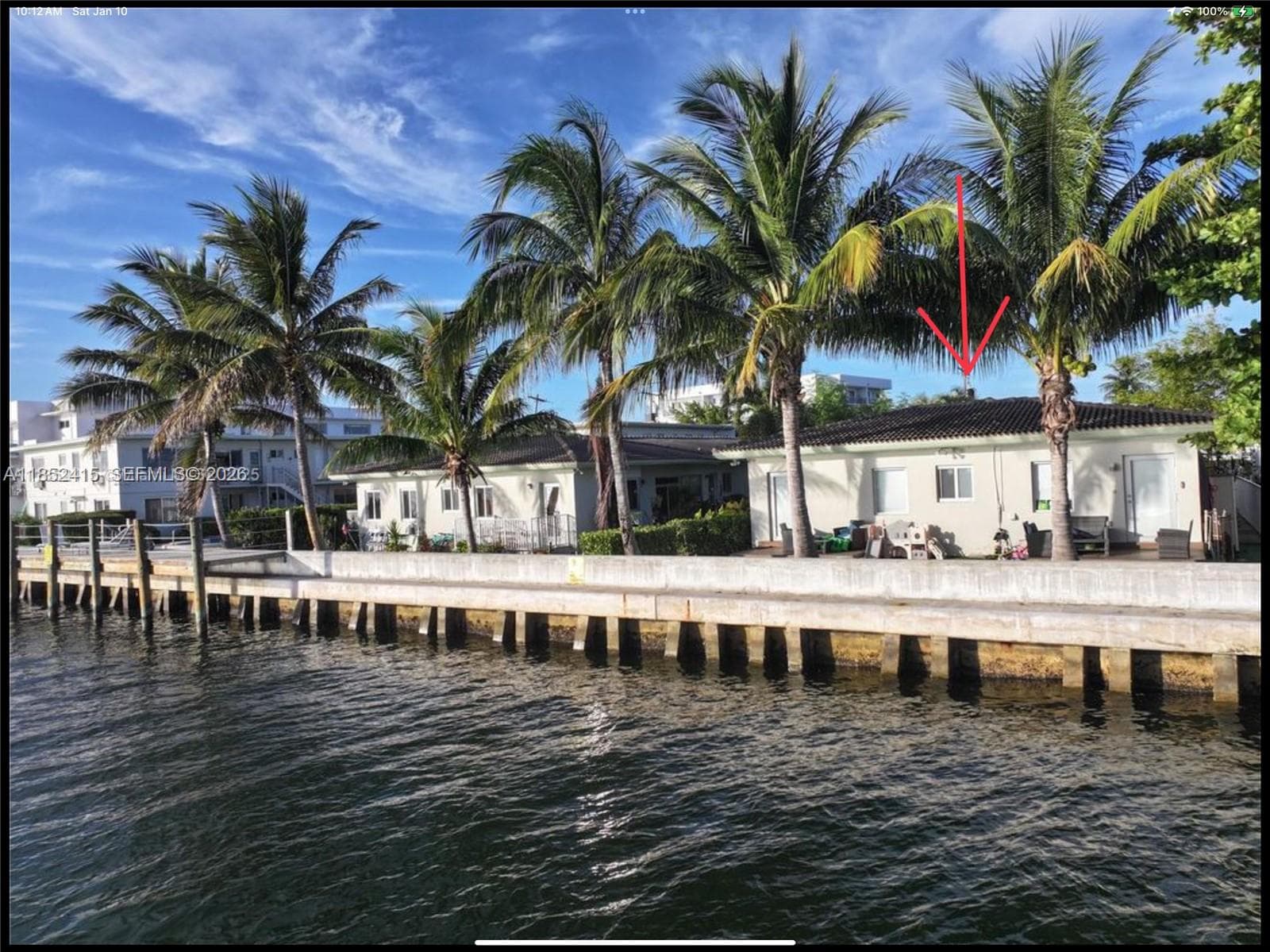 A11852415 — Miami Beach — 3