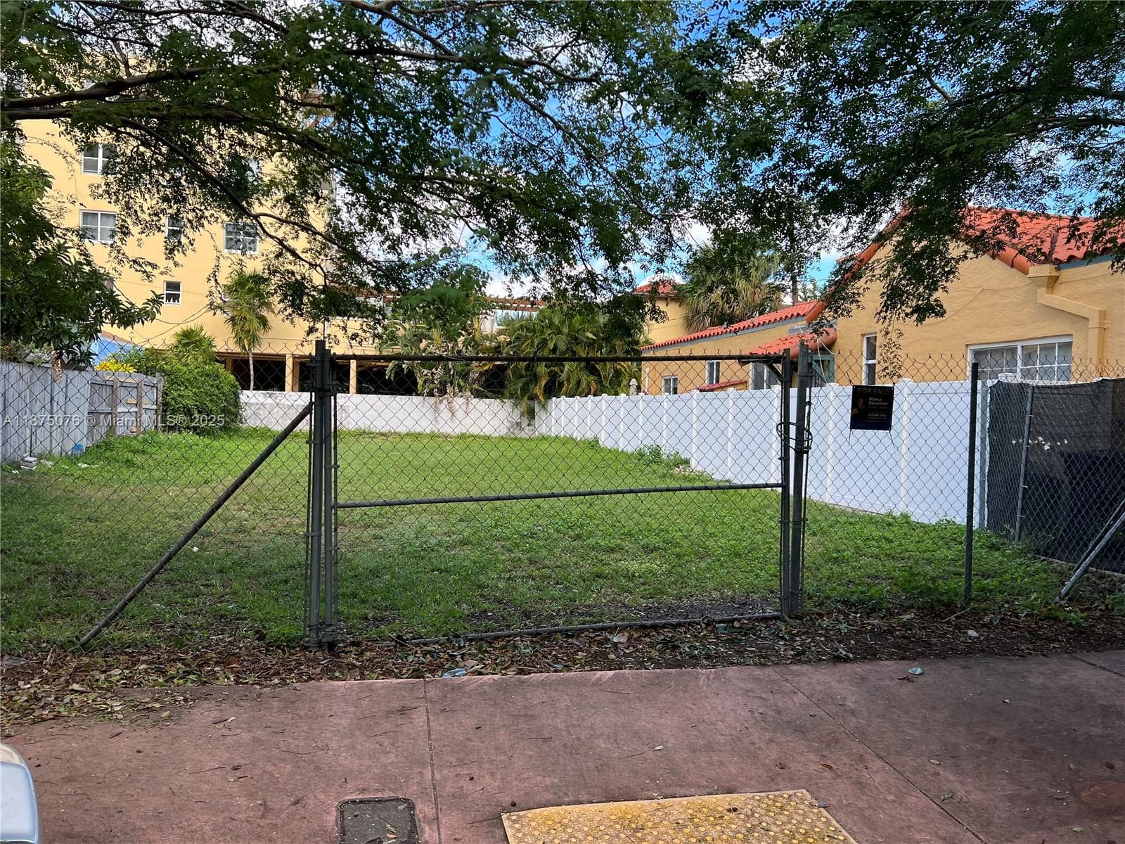 A11875076 — Miami Beach — 3