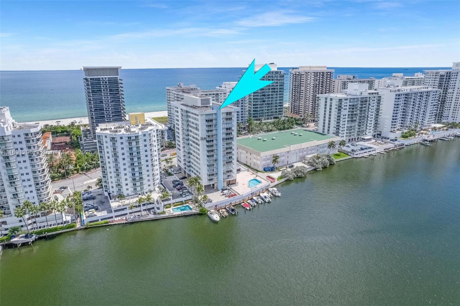 A11891296 — Miami Beach — 4